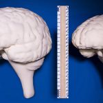 La Obesidad y/o el exceso de trabajo reducen el Tamaño de tu Cerebro