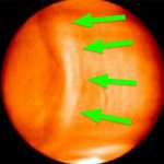 Una enorme anomalía en Venus